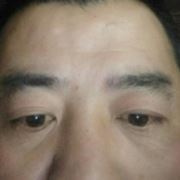 tcy~186590131